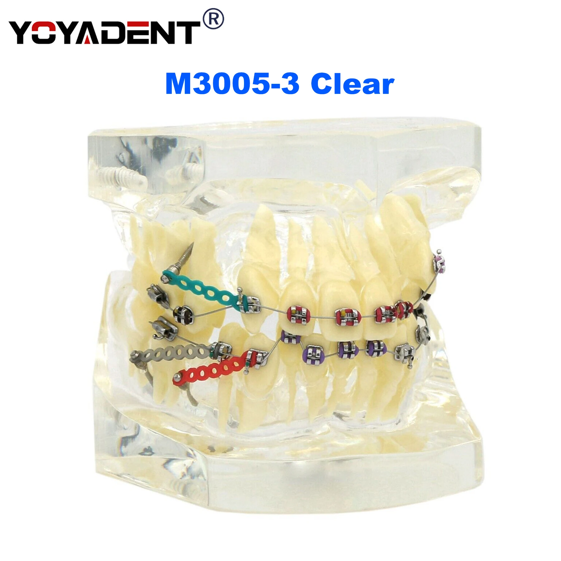 Dental Model Orthodontic Teeth Model  Metal Arch Wires Ties/ Ceramic Brackets  Orthodontic Correction Teaching