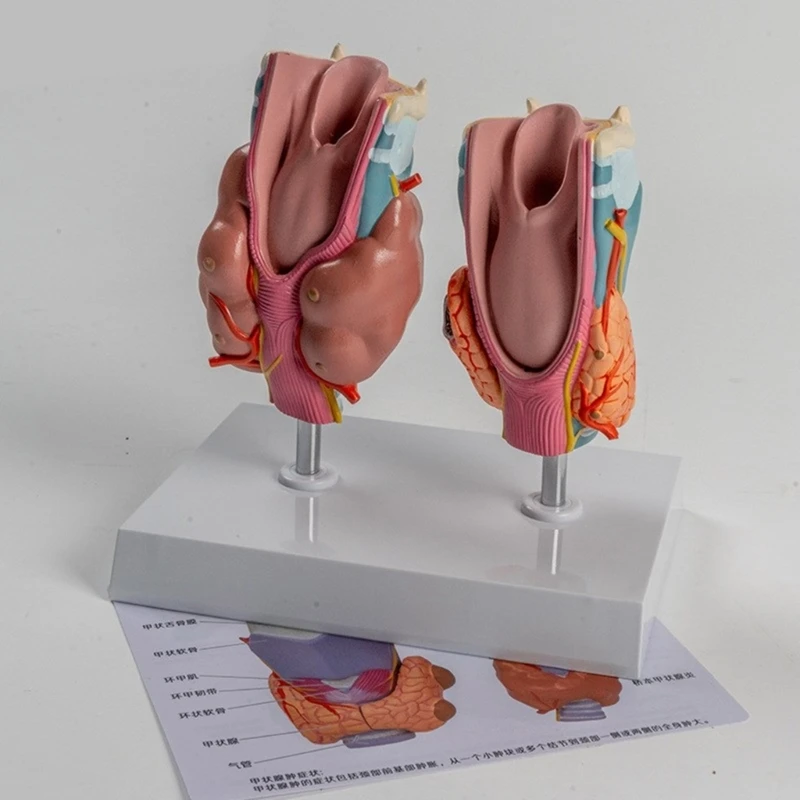 Модель патологической анатомии щитовидной железы со съемной частью, анатомическая модель щитовидной железы