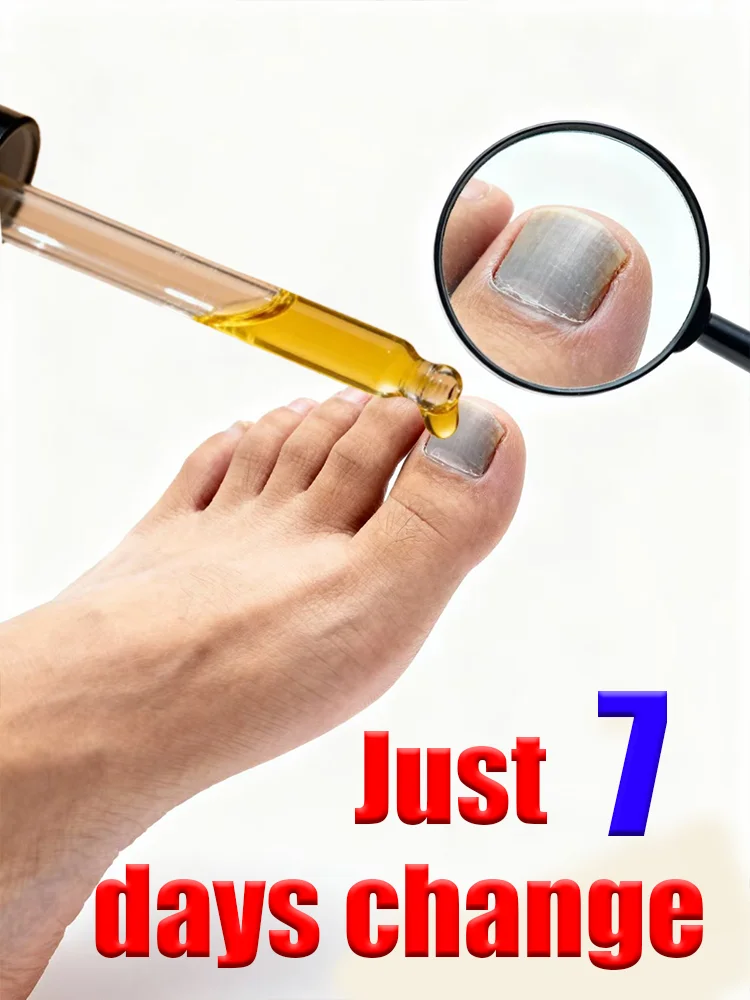 

A convenient tool for repairing discolored shell droppers