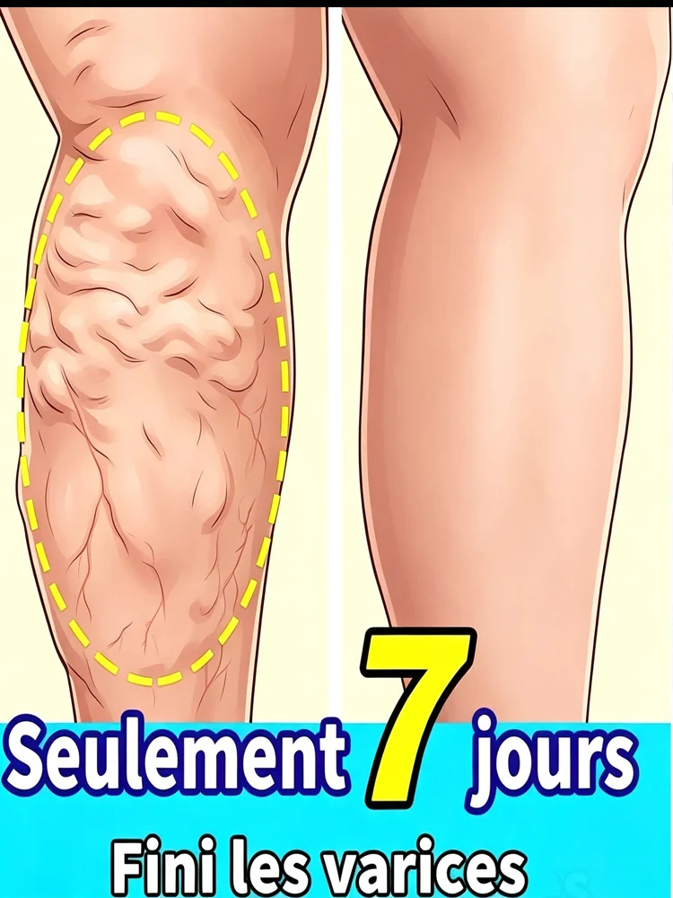 Vein Care cream to Relieve Foot Varicose Blood Vessel Blockage and Protrusion Cold Compress Vein Care cream Leg Foot Health Care