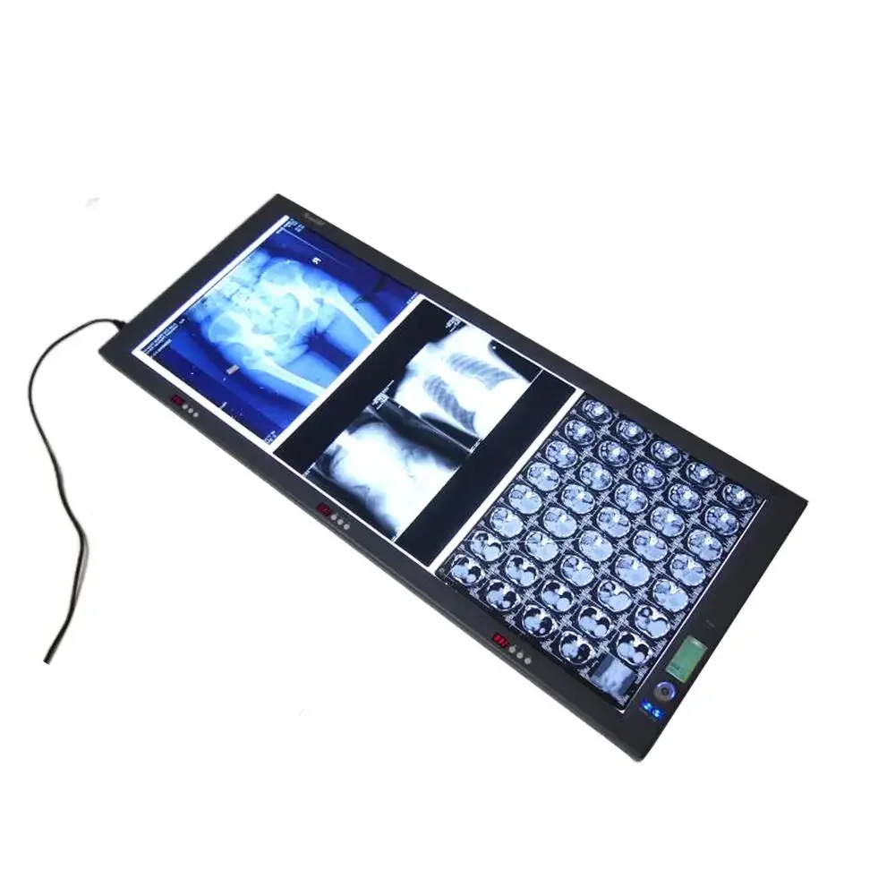 

LED medical film viewer triple screen