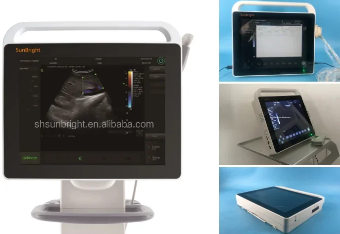 Digital Ecograph Touch Function Laptop Portable Black and White Ultrasound Machine SUN-800S