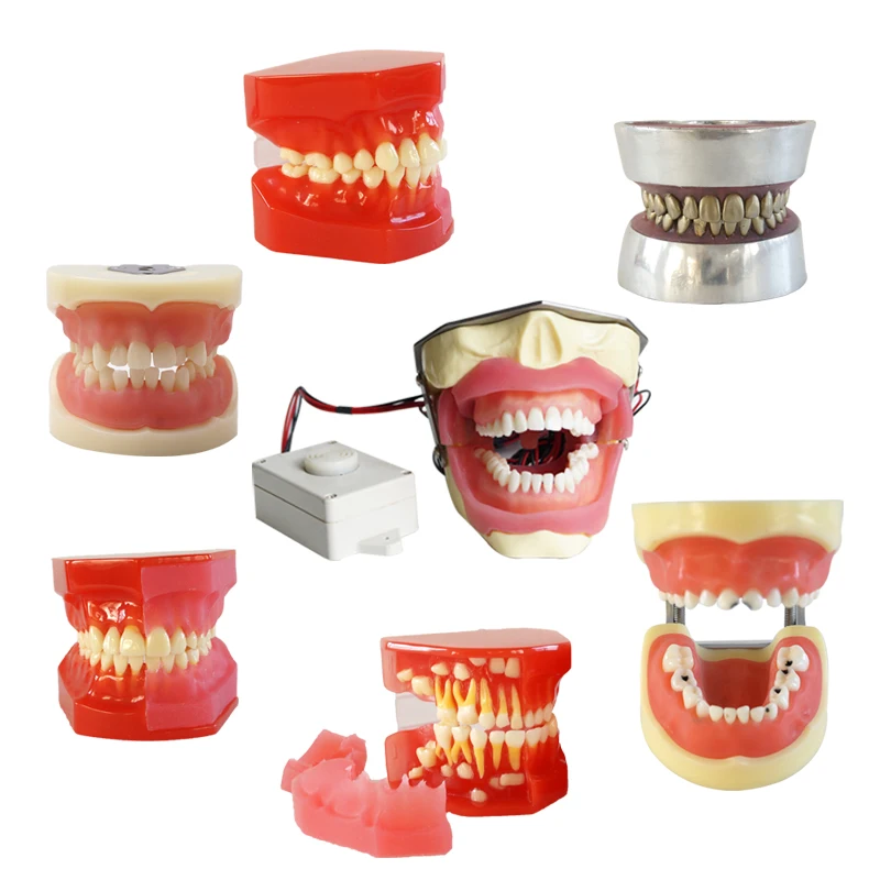 

Dental Teeth Model 3-6 Years Graghically Developing Model Child Caries Model Dentist Student Teaching and Study Dental Materials