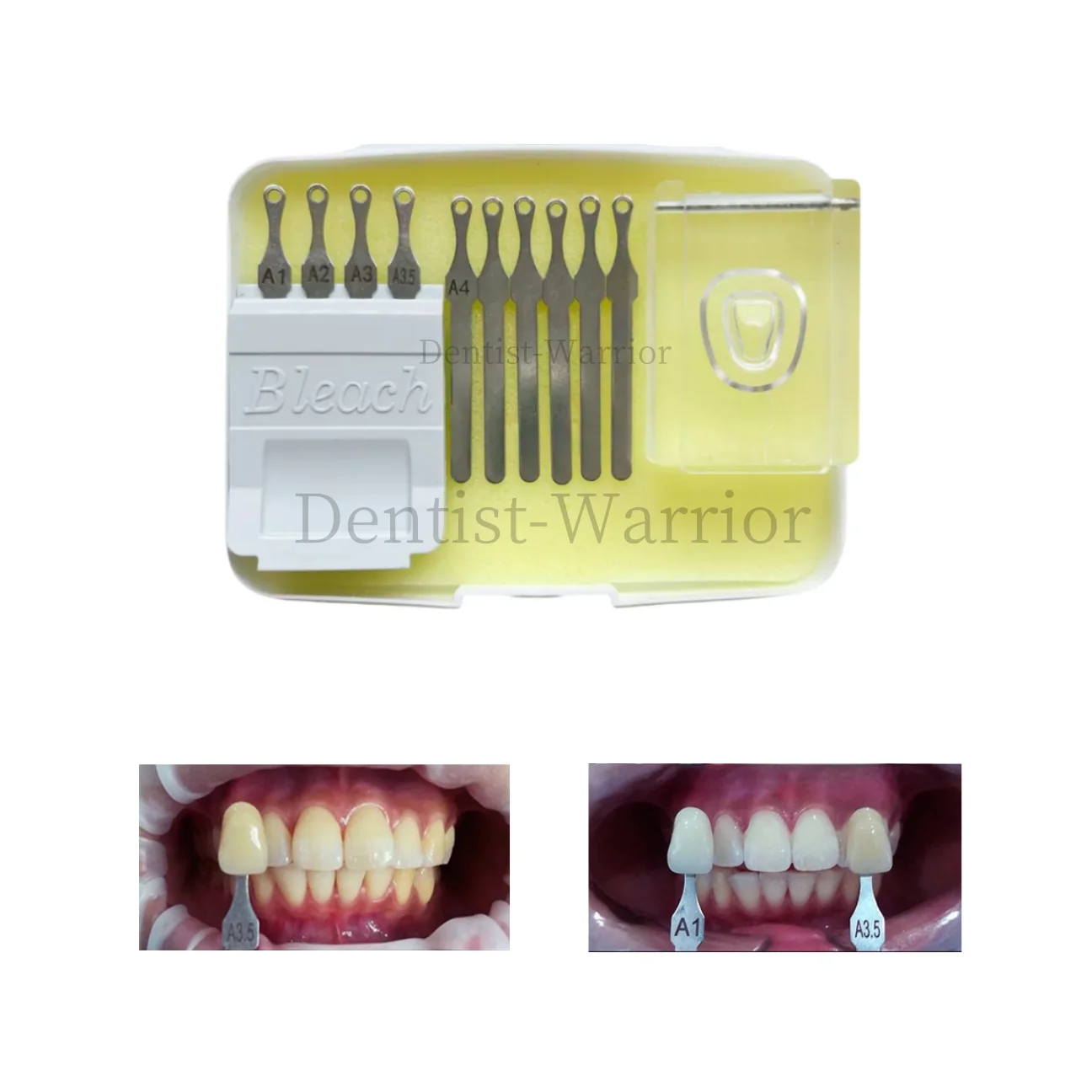 

Dental DIY Shade Guide Teeth Mould Make Own Custom Shade Composite Kit ﻿