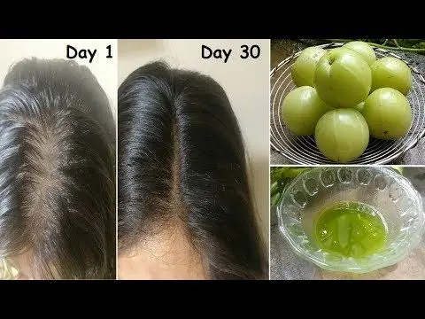 Extreme Hair Growth Oil, Chebe Hair Growth Oil Extra Strength Formula with Amla Coconut Oil for Receding Hairline DHT Blocker