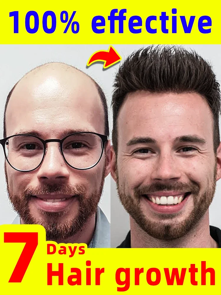 Anti-hair Loss Essence Promotes Hair Growth and Improves The Scalp Environment