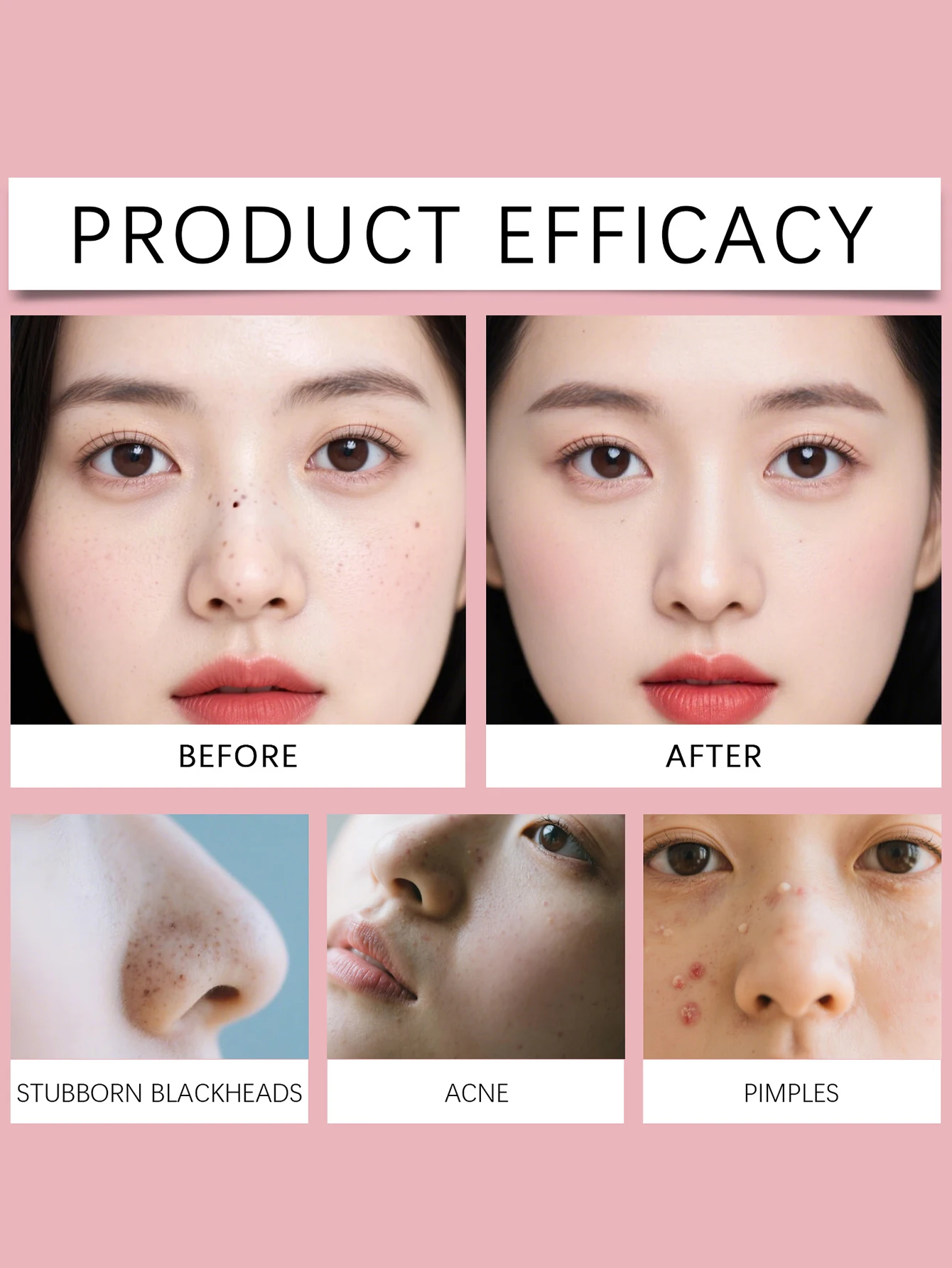 يحتوي صندوق واحد على 20 شريطًا لتنظيف المسام، وشرائط أنف لإزالة الرؤوس السوداء، وشرائط أنف لتقليل المسام.