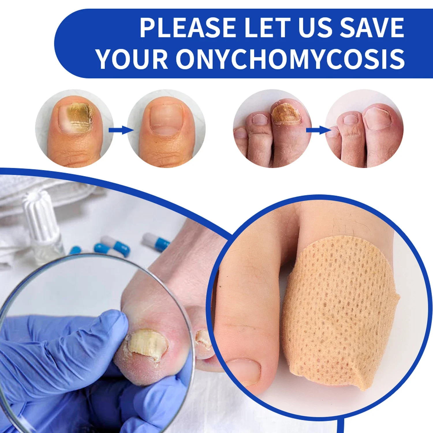 105/21 قطعة مسمار الفطريات التصحيح مقاوم للماء مسمار رقعة إصلاحية نام تصحيح ملصق التالفة مسمار رمادي الرعاية التصحيح قدم أدوات العناية