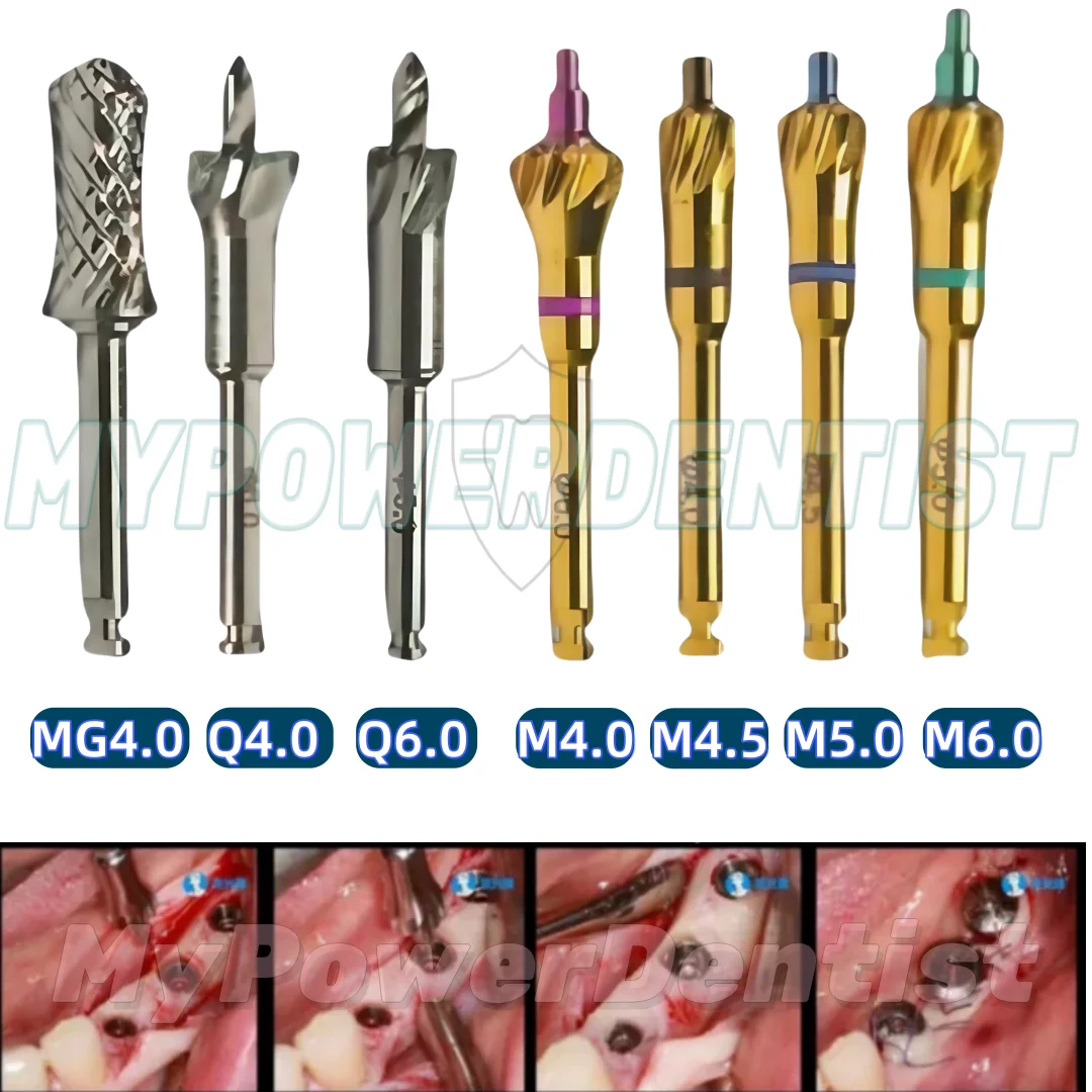 Dental Bone Profiler Grinding Bur Ridge Contouring Removal Drills Trimmer 7 Size