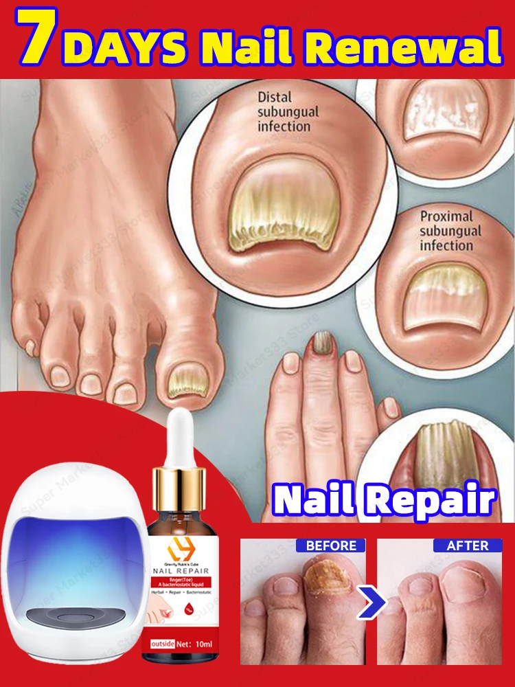 Solves all nail problems