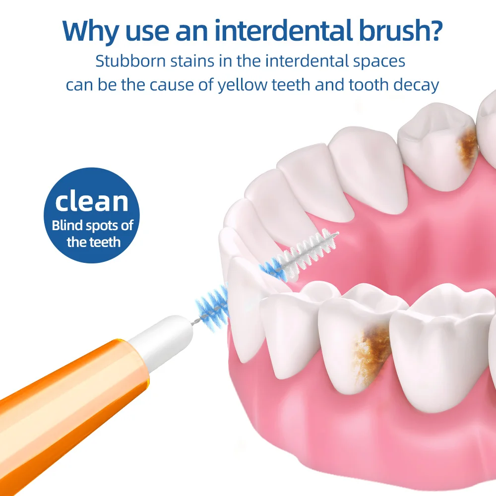 Super Deer I-type 0.7mm Interdental Brush Soft Bristle Interdental Tooth brushes Cleaning Between Teeth For Orthodonotics