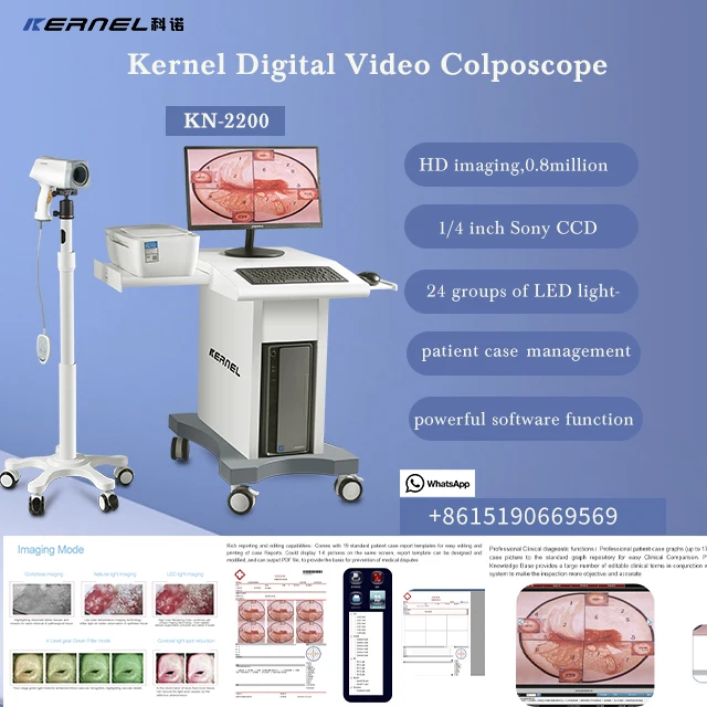 Gynecological Kernel KN-2200 Handheld Electronic Digital for Cervix, Vagina, and Vulva Examination