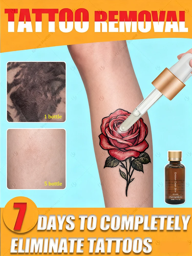 

Quick Tattoo Removal Serum in 7 Days