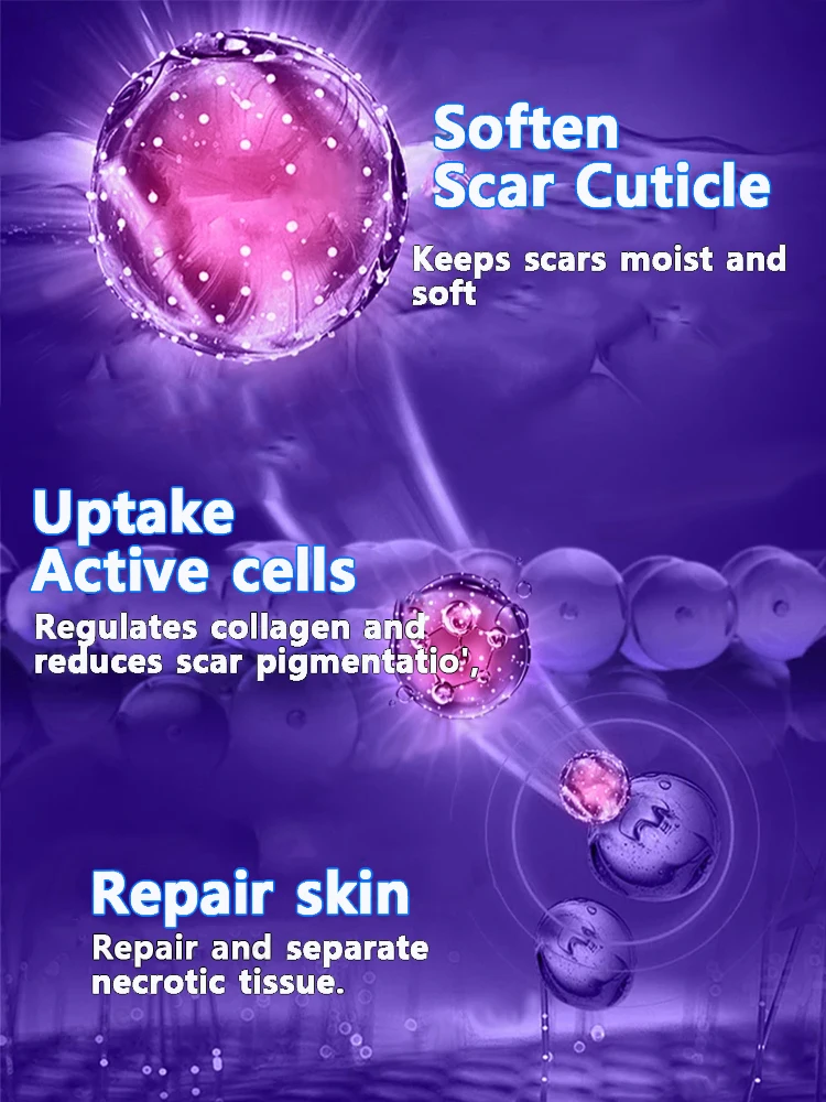 De nieuwste littekenverwijderingstechnologie, littekens binnen 7 dagen verwijderen, best verkocht product in Azië