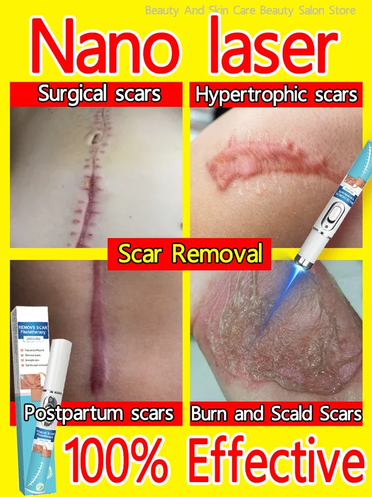 Scars? Knife scars? Surgery scars? Tattoo scars? Burn scars? Fall scars? Quick recovery in 7 days