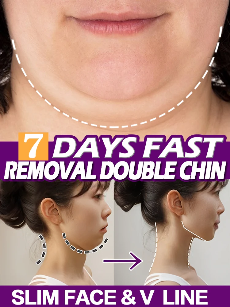 

V Shape Slimming Cream Firming Face-lift Remove Masseter Muscle Double Chin Tighten Mandibular Fat Burning Cream Fade Neck Lines