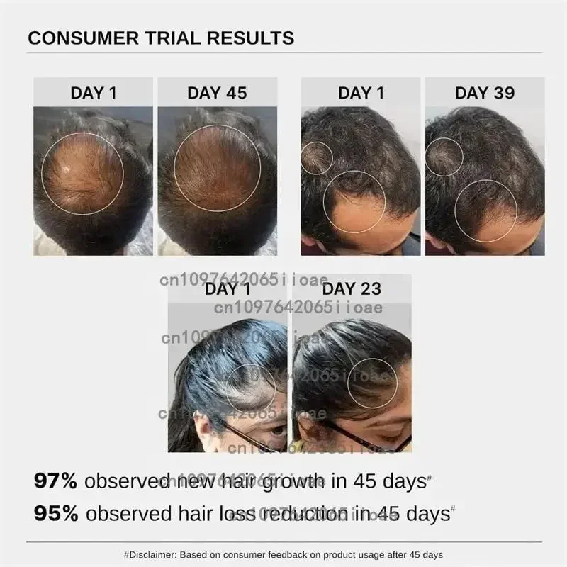 30Pflaster Haarwachstum Biotin Plus Pflaster für Frauen, Biotin Plus Polygonum Multiflorum