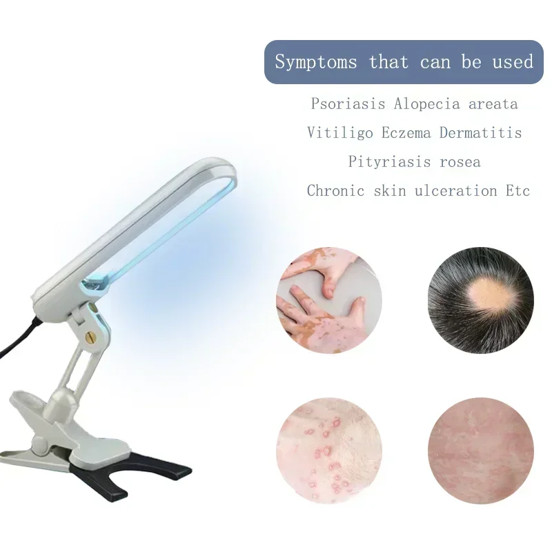 Get Clear Skin with UVB Phototherapy Narrow 311nm UV Lamp: Ideal for Psoriasis and Vitiligo