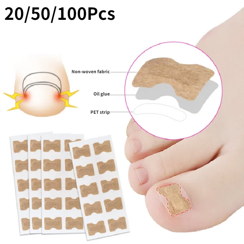 20/50/100pcs Nail Correction Stickers Ingrown Toenail Corrector Patches Paronychia Treatment Recover Corrector Pedicure Tools