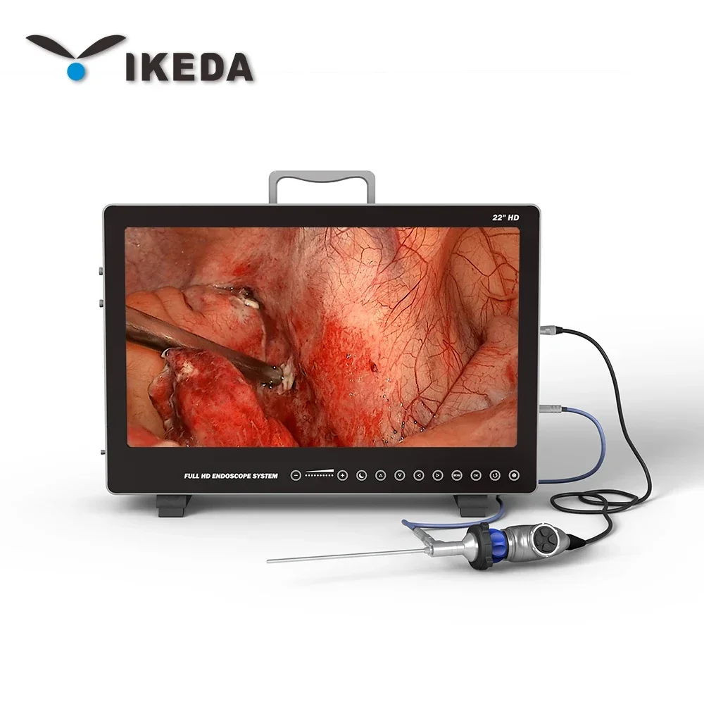 IKEDA 9122 Portable Endoscopy Medical Imaging Equipment HD Endoscope For ENT/Laparoscopy/Hysteroscopy/Urology