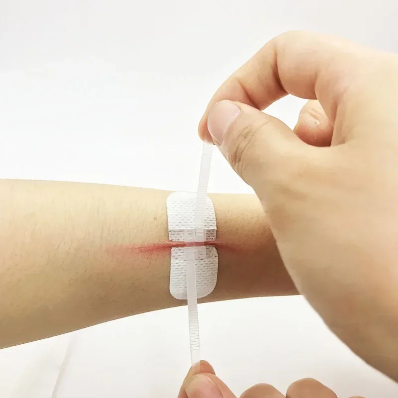 

6Pcs 2Bags Zipper Tie Wound Closure Strip Hemostatic Patch Fast Suture Zipper Band-aid Wound Dressing Painless Wound Repair