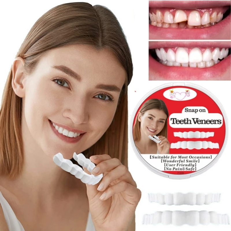 

Fake Tooth Cover Snap On Teeth Veneers For Men And Women Cover The Teeth Fake Tooth Instant Confidence Smile Temporary Teeth