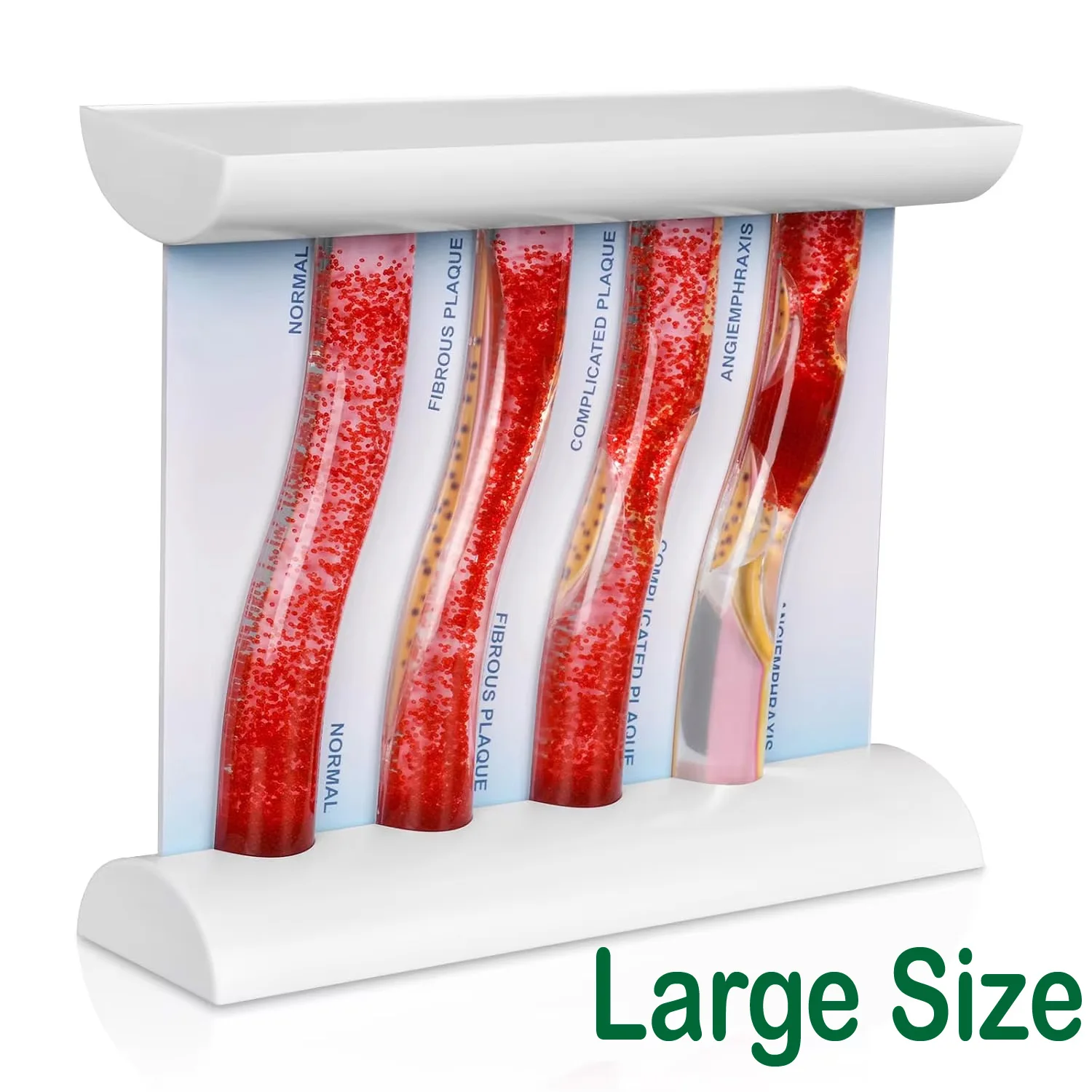 Ultrassist LDL Blood Vessel Model Low-Density Lipoprotein Vascular Drip Demonstration Tool for Medical Anatomy Student Education