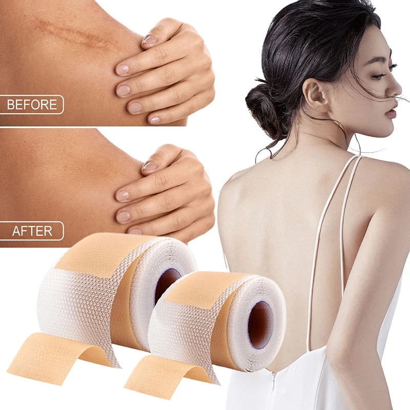 Silicone Scar Patch Nude Scar Tape Roll Scar Sheet Removal Self-Adhesive Tape Therapy Patch Burn  Surgical Scar Skincare