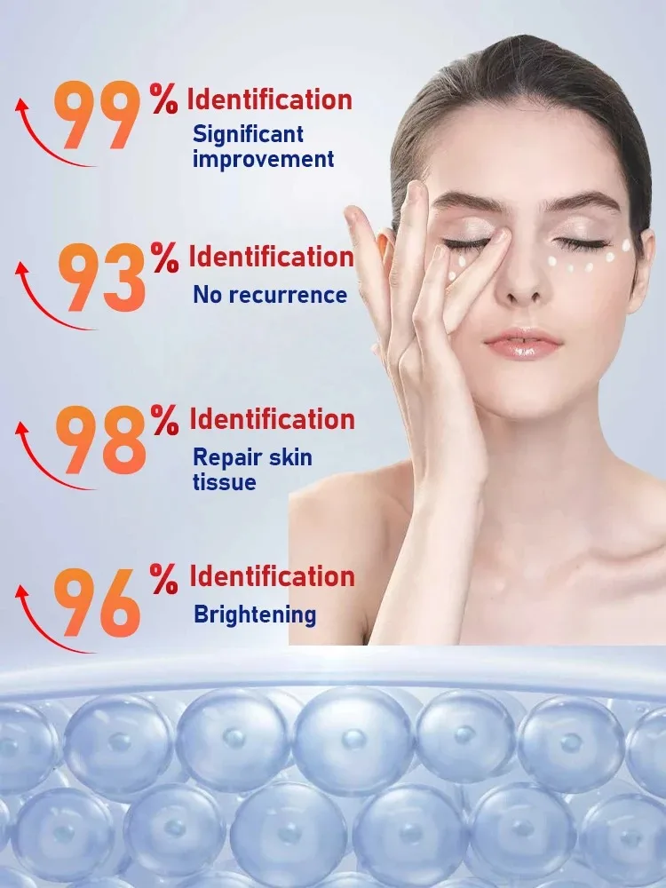 3차 주름 제거 아이크림 눈가 다크서클 붓기 완화 탄력 크림 눈 밑 미백 잔주름 보습