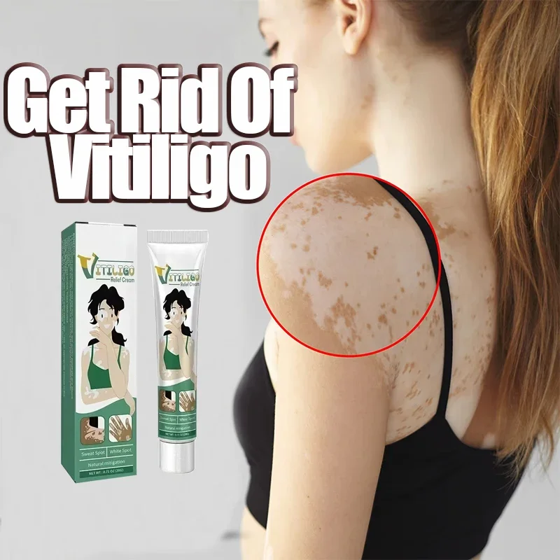 Pomada de Vitiligo para eliminar eficazmente las manchas blancas, elimina el Vitiligo de la piel, cuidado de la piel corporal