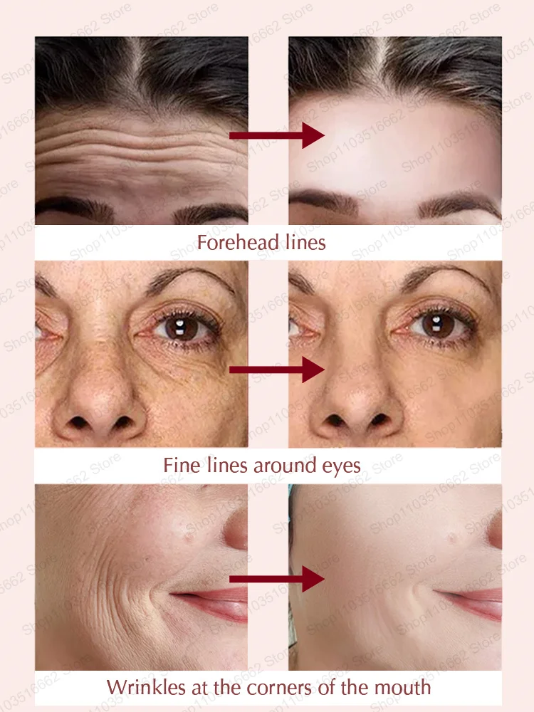 Wrinkle-free face