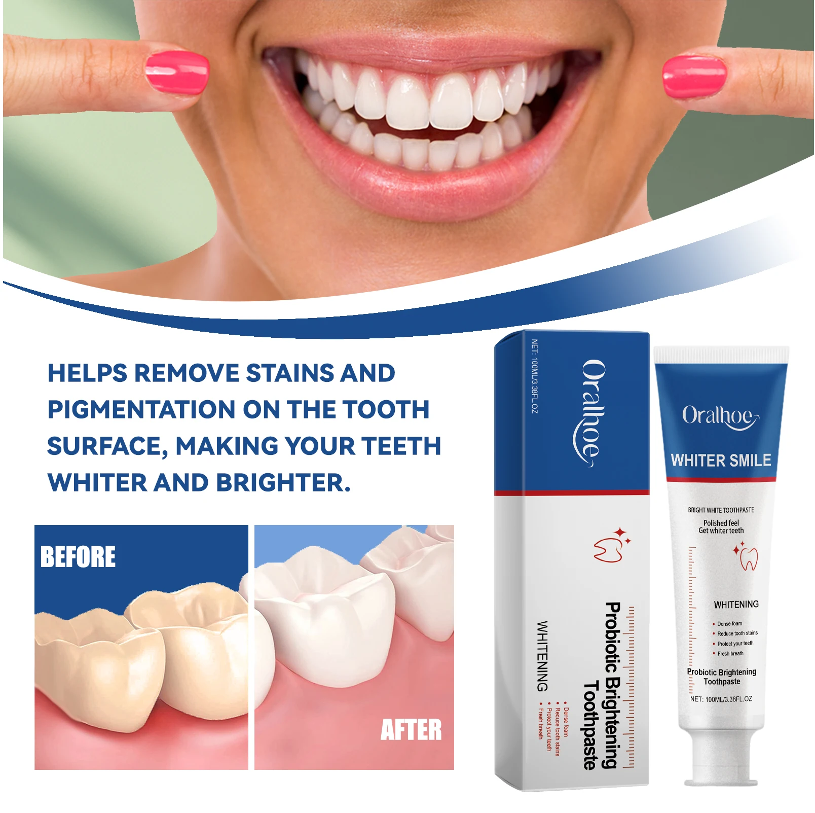 Probiotic Toothpaste Whitens Teeth, Removes Plaque and Stains, Tooth Whitening Agent, Oral Hygiene, Cleans and Freshens Breath