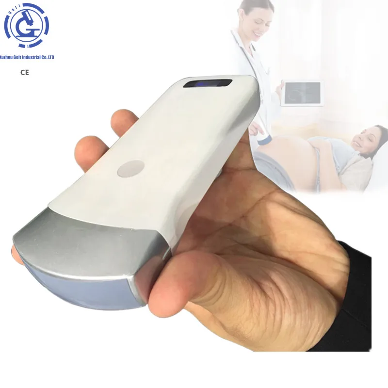 CE Ecografo wireless wifi usb color doppler ultrasound convex probe