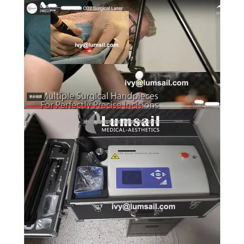 Surgical Urologic Oncologist Use Veterinary Device Pet Surgical CO2 Laser Machine