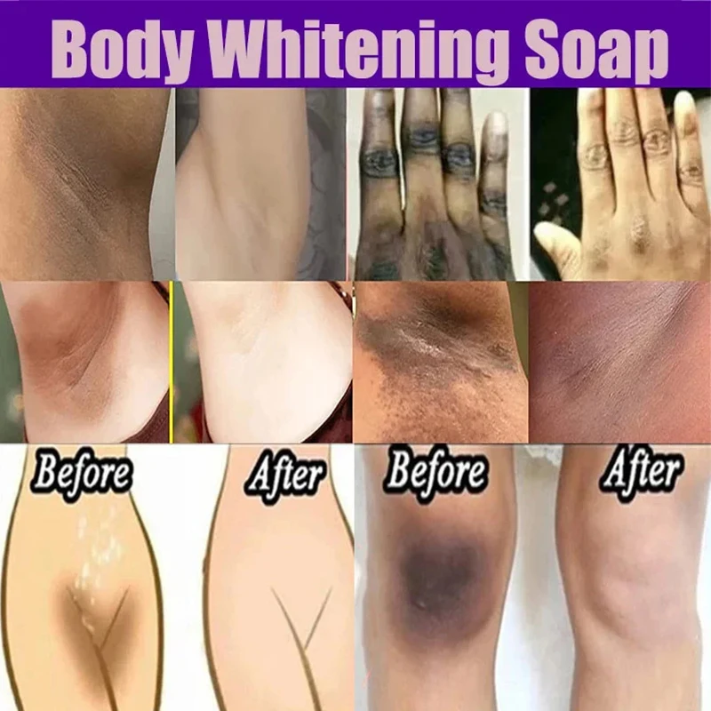 Body Brighten White Care Products Body Whitening Soap Deep Clean Skin Chicken Skin Removal Soap Armpit Underarm Knees Bleaching