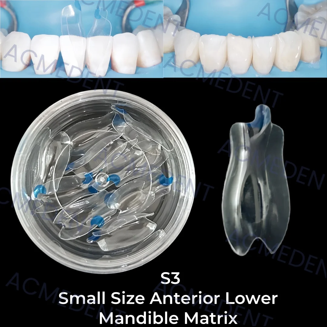 S3 Dental Transparent Matrix Clear Matrix Anterior Lower BT Bow Maxillary Matrices Contoured Fit BioClear Matrice Black Triangle