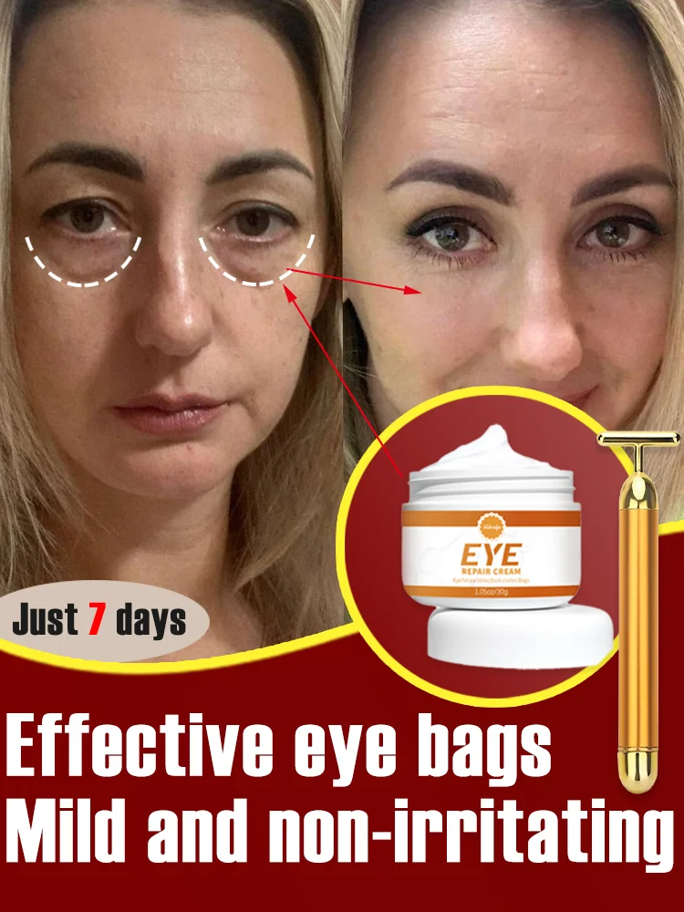 

Caffeine Eye Cream and Eye Bag Dark Circles Cream Makeup Anti Dark Circle Anti Bags Under the Eyes Korean Skin Care Products