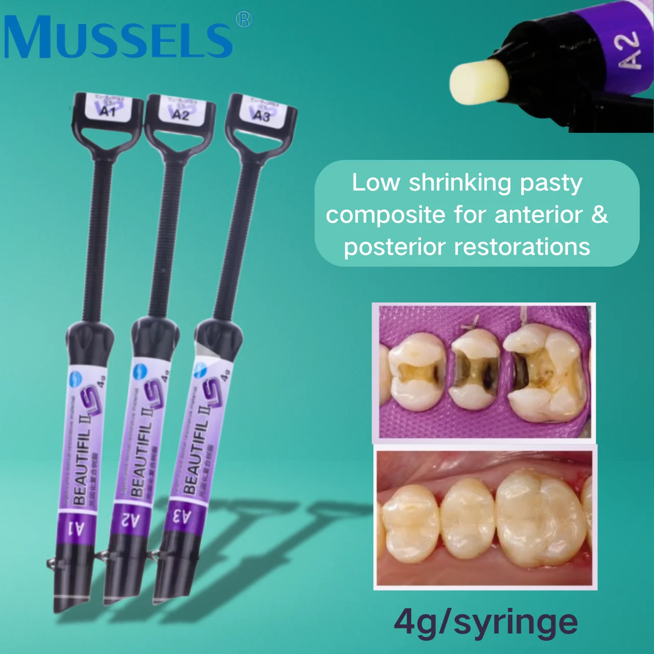 

4g Dental Light Curing Resin Syringe Low Shrink Direct Composite Teeth Repair Aesthetic Restoration Filling Dentistry Materials