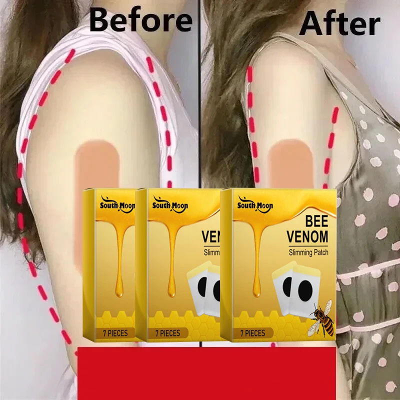 Südmond Bienen gift Faser Abnehmen Nabel Gewicht verbrennen Fett Taille Bauch Diät Gewichts verlust Produkte Anti Cellulite dünne Oberschenkel