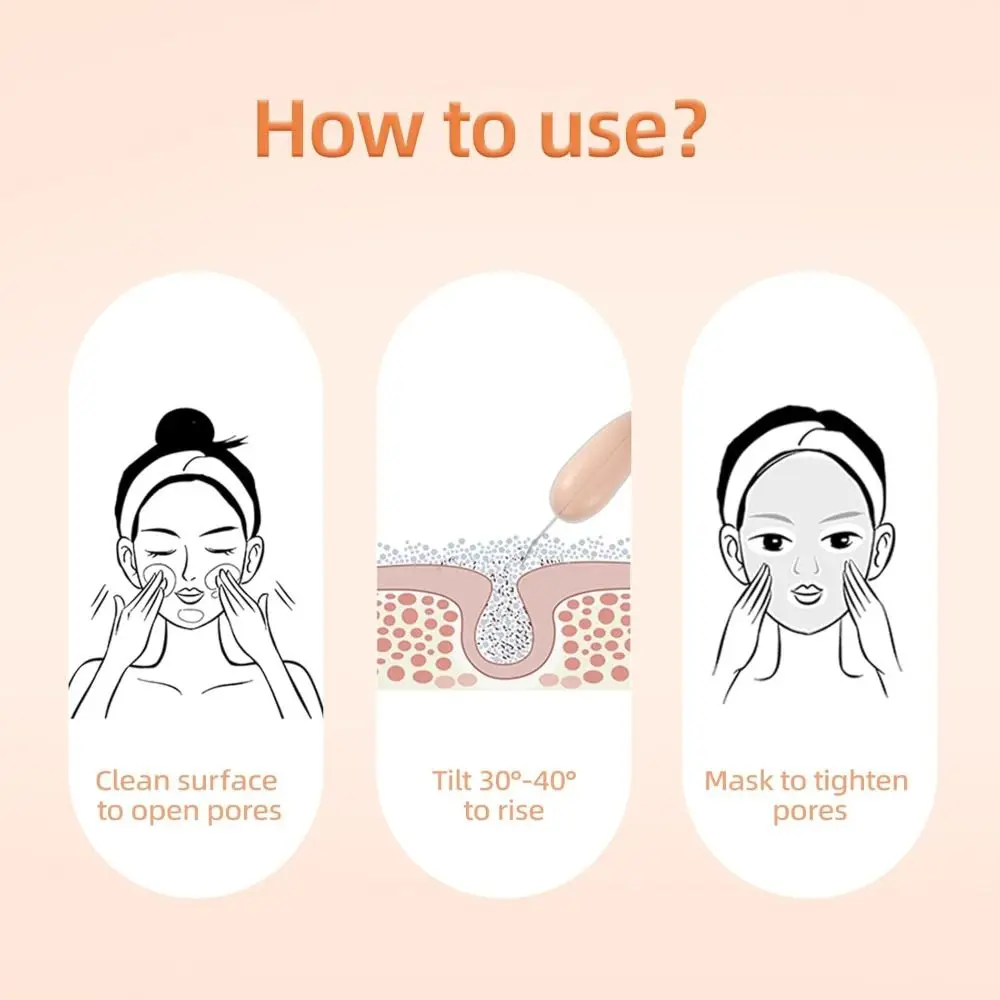 Dissolvant de points noirs, spatule pour la peau, épurateur, nettoyage en profondeur, outil d'élimination des points noirs doux, Durable, facile à nettoyer