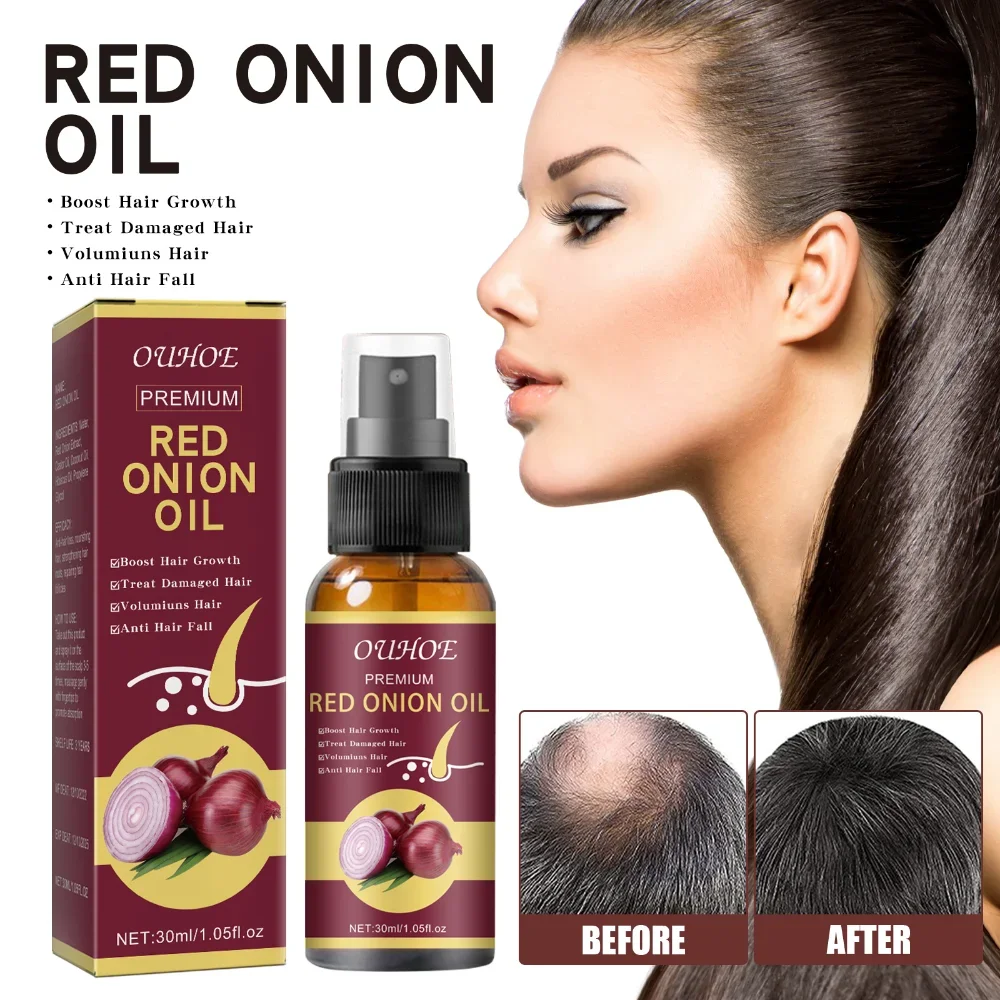 Onion Black Seed Hair Oil Spray for Natural Hair Care and Growth Prevent Hair Loss Biotin Fast  Growth