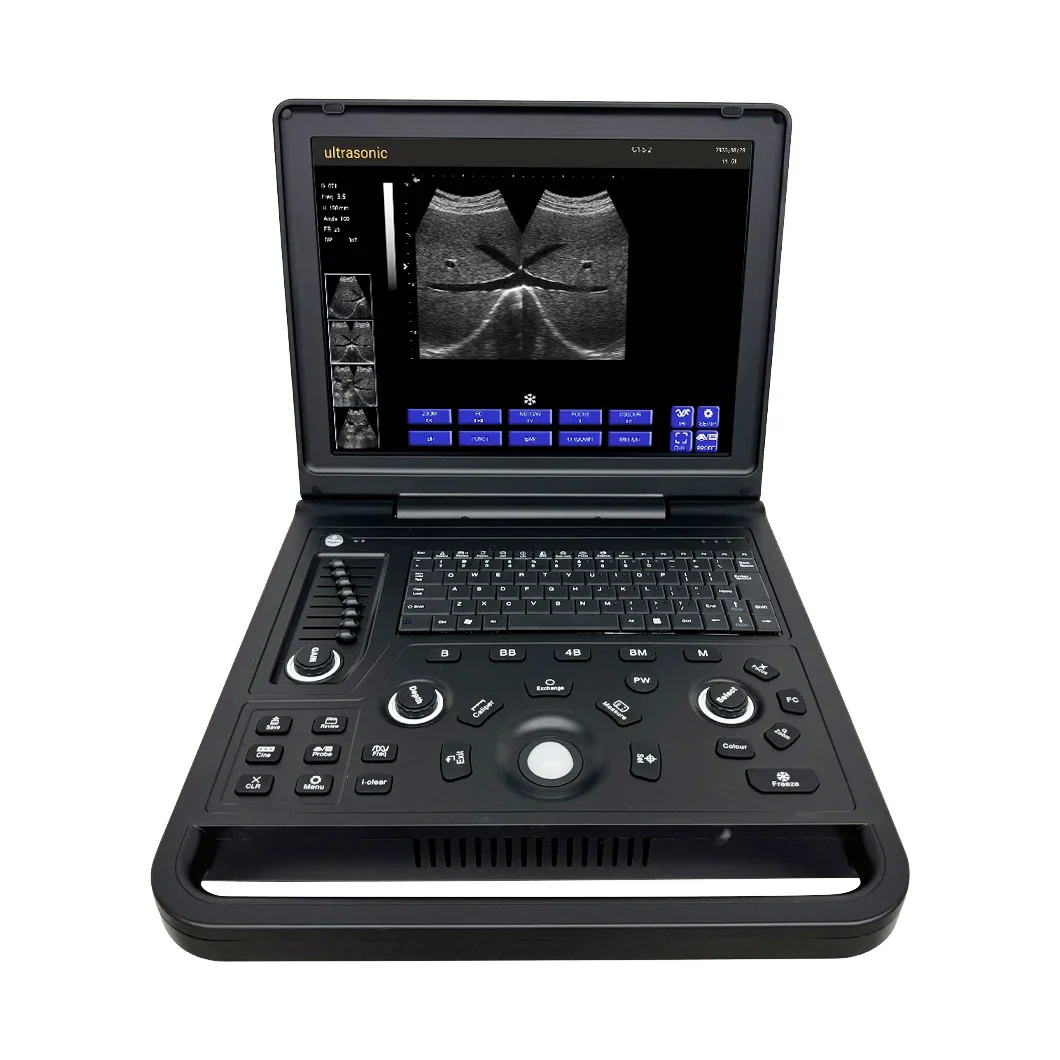 Clinic Medical 15 Inch LCD Screen Medical Portable Laptop B/W Ultrasound Scanner