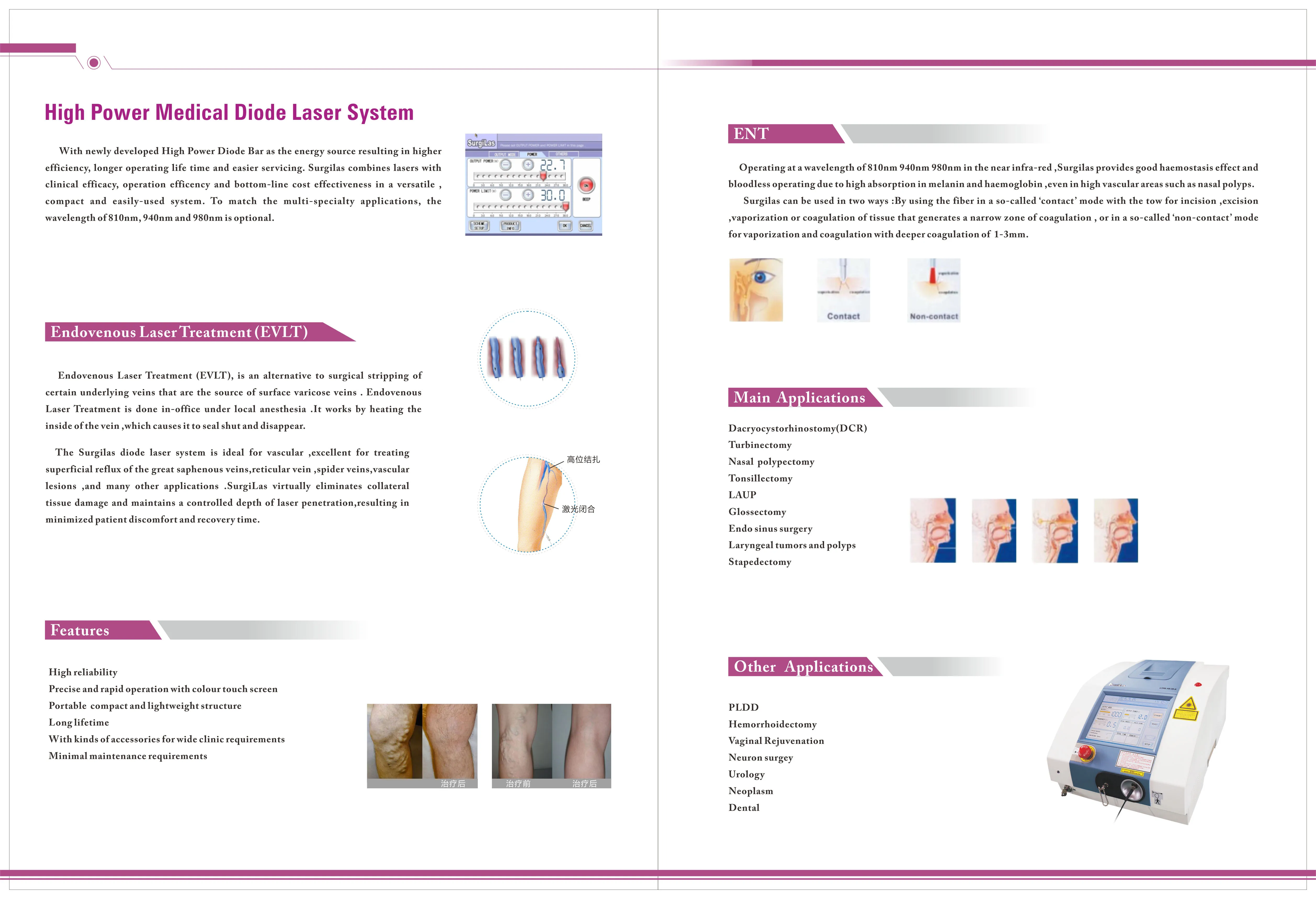 2020 980nm diode laser laser spider vein removal machine radiofrekans ablation varix 30 Mb rcrema para las varices