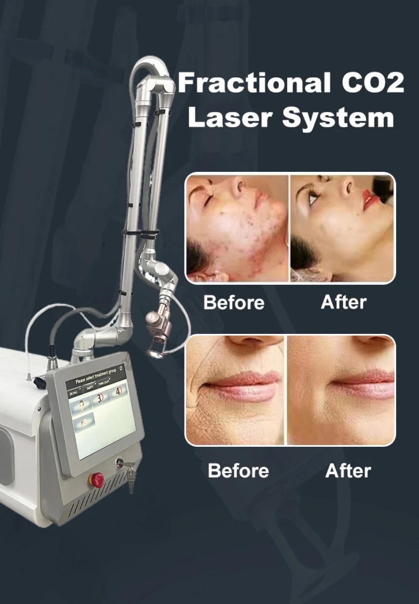 Fractional 4D Laser Machine Professional Portable CO2 Bison Meter 4D Photon Mini Skin Lift Trace Treatment Device Salon