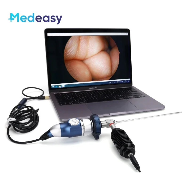 Medical Portable Multi-Display USB & HDMI HD 1080P Endoscope Camera