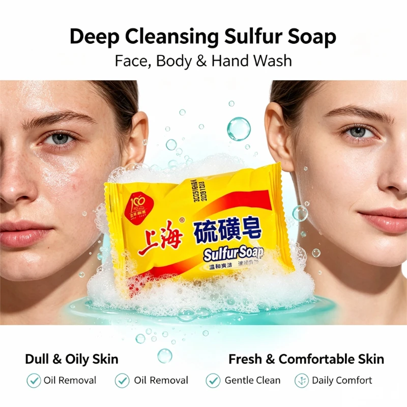 2026 Shanghai Sulfur Soap 3/5PCS Acne Treatment Deep Cleansing Oil Control Face & Body Wash Mite Removal Skin Comfort Unisex