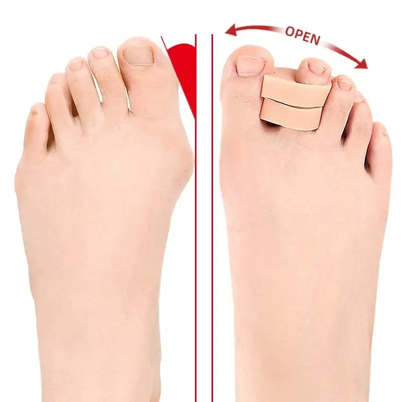 

1/2/10Pairs Silicone Gel Thumb Corrector Bunion Toe Hallux Valgus Protector Separator Fingers Straightener Adjuster Foot Care