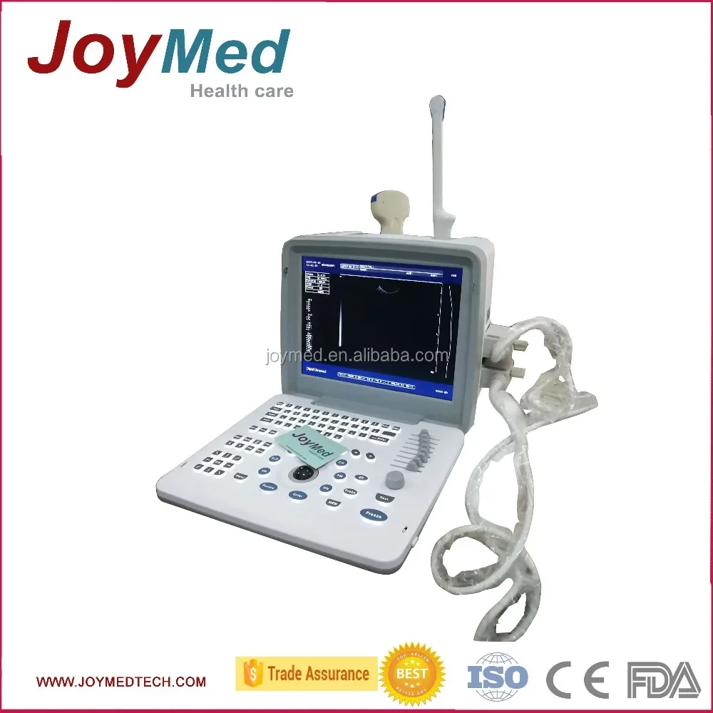 China Medical Ultrasonic Equipment portable ultrasound machine trade assurance ultrasound scanner with cheap price