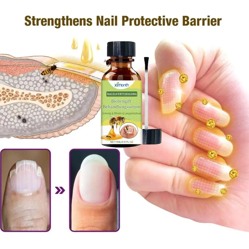 Hot Defense Nail Treatment Serum Bee Venom Nail Growth Nail Growth Serum Nail Repair Bee Venom for Nail Strengthener