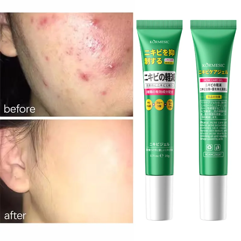 

Pore Shrinking Cream Elimination Large Pores Blackehead Remove Acne Pit Repair Gel Tighten Face Smooth Skin Korean Care Products